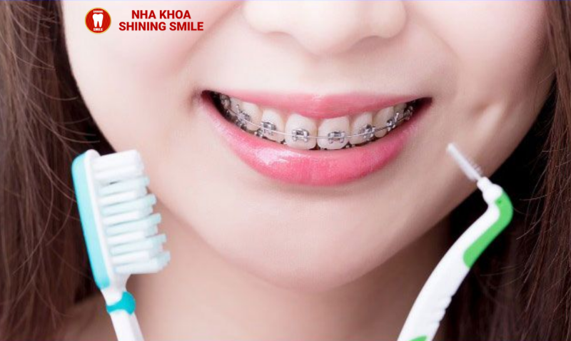 Niềng Răng Gây Ê Buốt Khi Uống Nước: Nguyên Nhân và Cách Khắc Phục