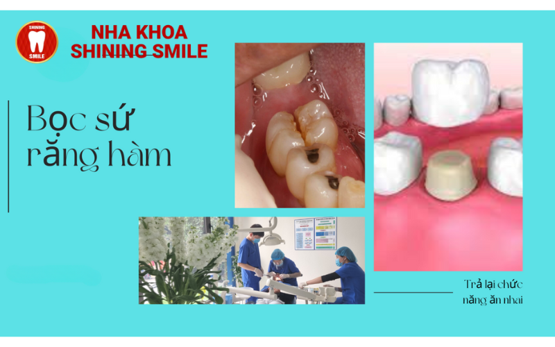 Dịch Vụ Hàn Răng: Quy Trình, Chi Phí Và Lợi Ích