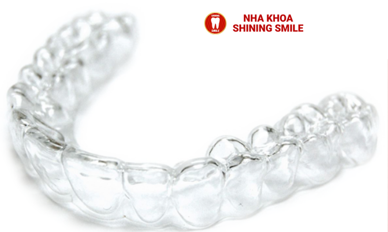 Các Loại Niềng Răng Trong Suốt: Phương Pháp Nào Phù Hợp Với Bạn?