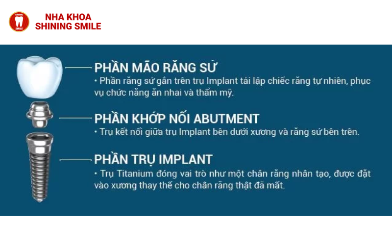 Trồng Răng Implant Giá Bao Nhiêu? Bảng Giá Cập Nhật Mới!