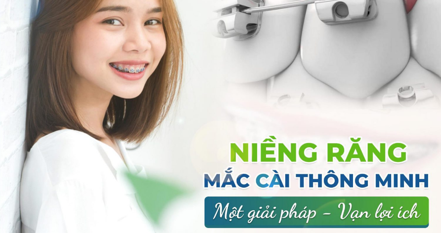 Công Nghệ Mắc Cài Thông Minh: Bước Đột Phá Trong Niềng Răng
