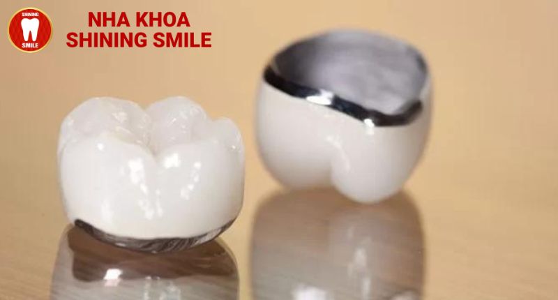 Răng Sứ Crom Cobalt: Giải Pháp Tối Ưu Cho Nụ Cười