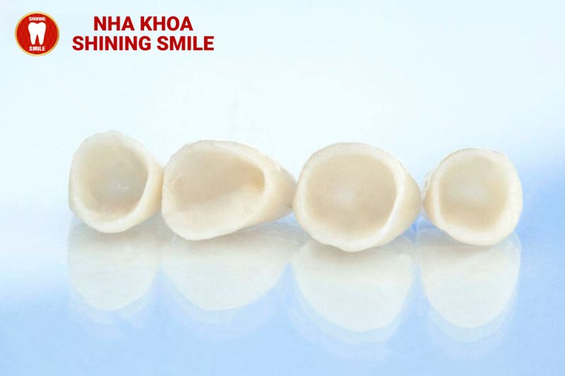 Răng Sứ Cao Cấp: Lựa Chọn Hoàn Hảo Cho Nụ Cười Đẹp