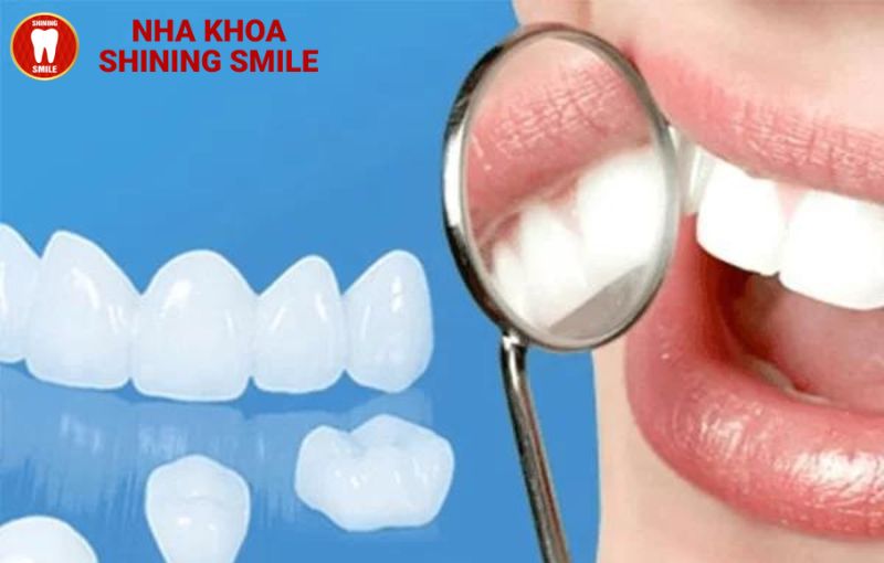 Răng Cercon HT: Sự Khác Biệt Và Ưu Điểm