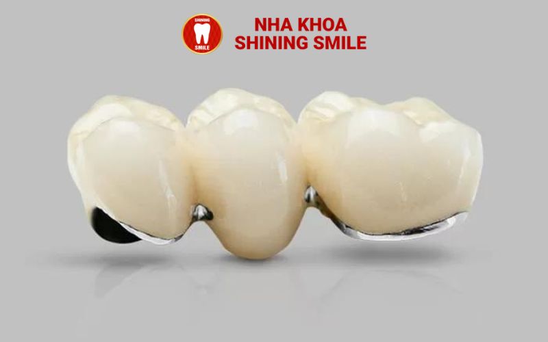 Giá Răng Sứ Thẩm Mỹ: Lựa Chọn Phù Hợp Với Túi Tiền