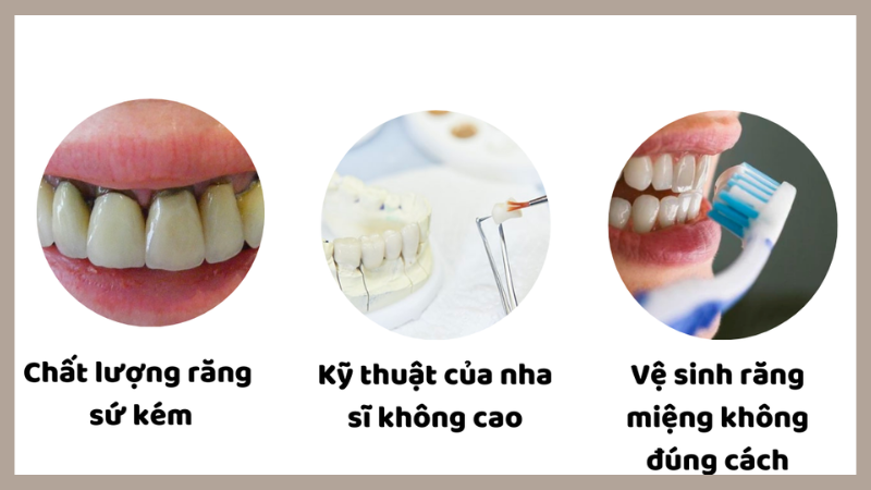 Răng Sứ Có Bị Ố Vàng Không? Bảo Quản Như Thế Nào?