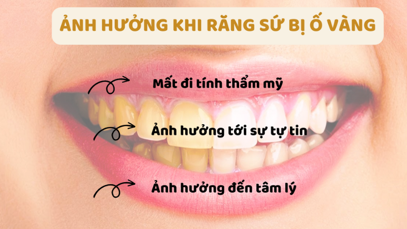 rang-su-co-bi-o-vang-khong2.png