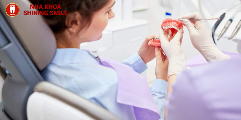 Niềng răng có phải nhổ răng không? Khi nào cần?