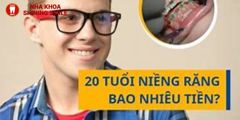 Chi phí từ A-Z niềng răng 20 tuổi