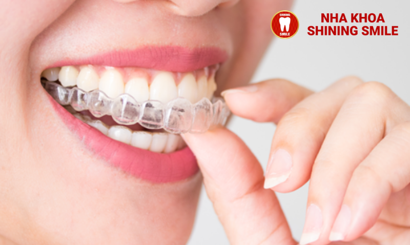 So Sánh Niềng Răng Zenyum và Invisalign: Điểm Mạnh Và Điểm Yếu