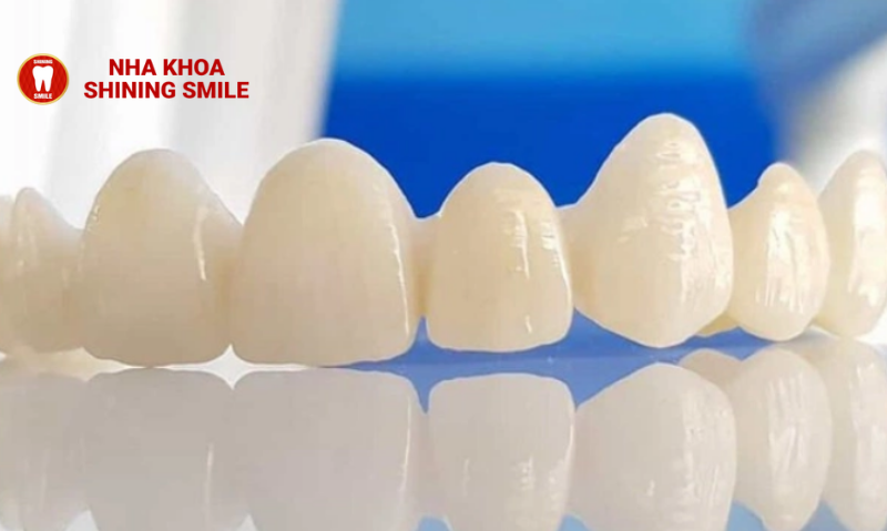 Răng Thưa Nên Niềng Hay Bọc Sứ? Giải Pháp Tối Ưu Cho Nụ Cười Hoàn Hảo