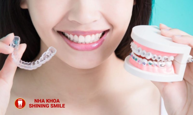 Niềng Răng Kéo Hàm: Giải Pháp Hoàn Hảo Cho Răng Hô, Vẩu