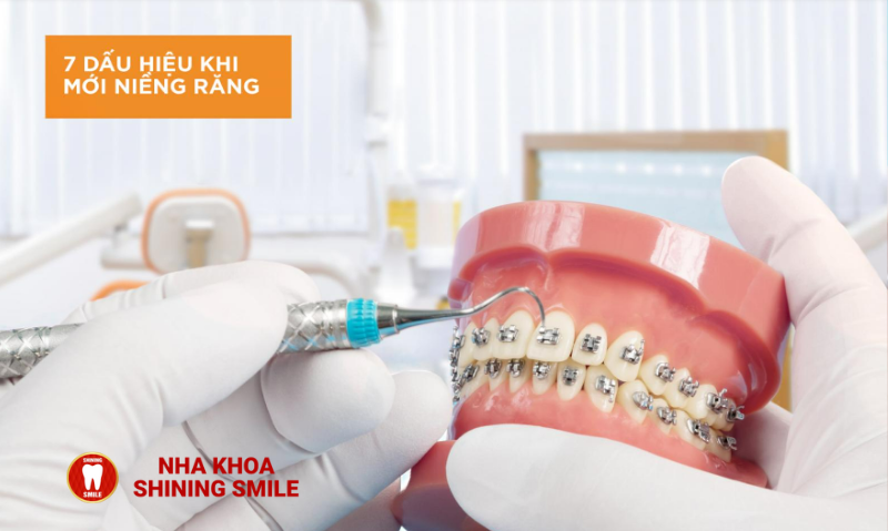 Những Dấu Hiệu Khi Mới Niềng Răng Bạn Cần Biết