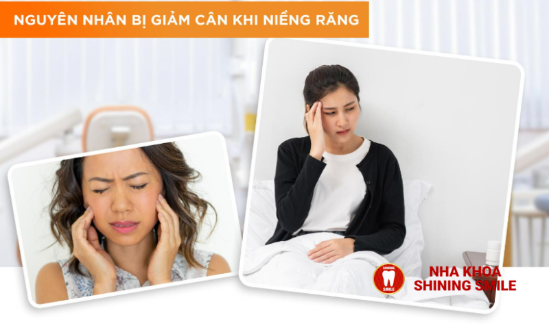 Niềng Răng Có Giúp Giảm Cân? Sự Thật Đằng Sau Mỹ Thuật và Sức Khỏe