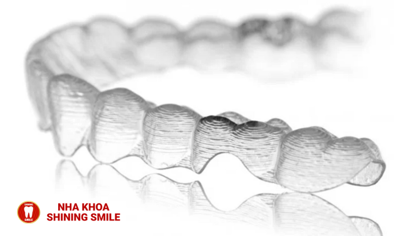 Niềng Răng Trong Suốt Clear Aligner: Lựa Chọn Thẩm Mỹ Hoàn Hảo
