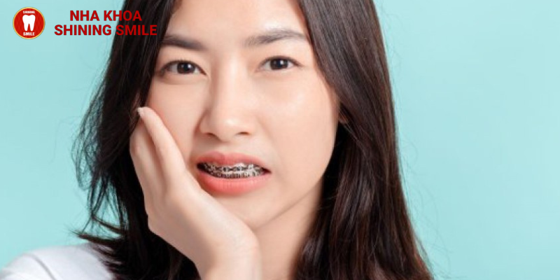 Cách giảm đau sau mấy ngày đầu niềng răng