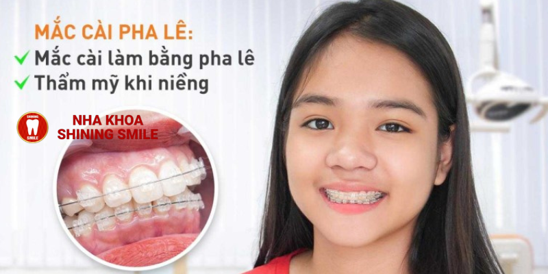 Bí Mật Niềng Răng Mắc Cài Pha Lê - Giá Hợp Lý tại SHINING SMILE