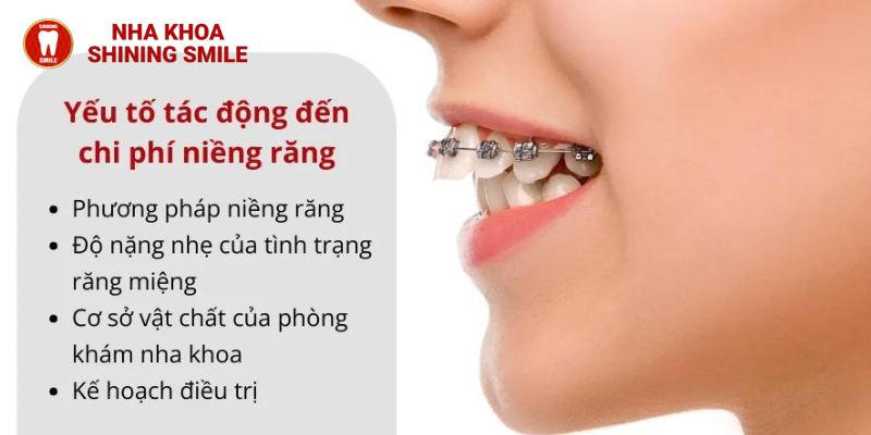 Khám phá bí mật: Niềng răng 14 tuổi - Bạn cần bao nhiêu tiền