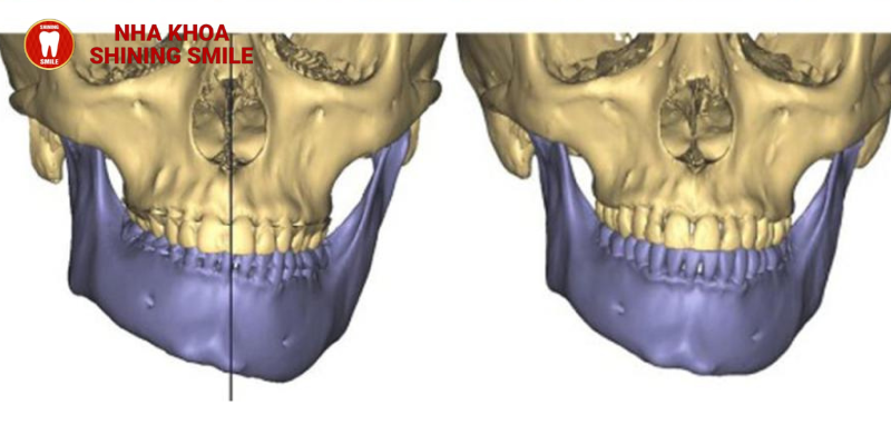 thiet-ke-chua-co-ten-2024-06-05t043438-090-2.png