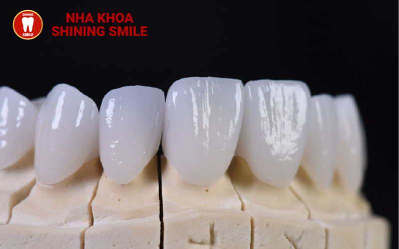 Răng Sứ Katana: Sự Lựa Chọn Hoàn Hảo Cho Hàm Răng Khỏe Đẹp