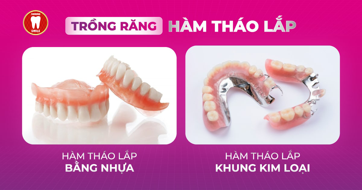 trong-rang-ham-gia-thao-lap-voi-2-loai-07.png